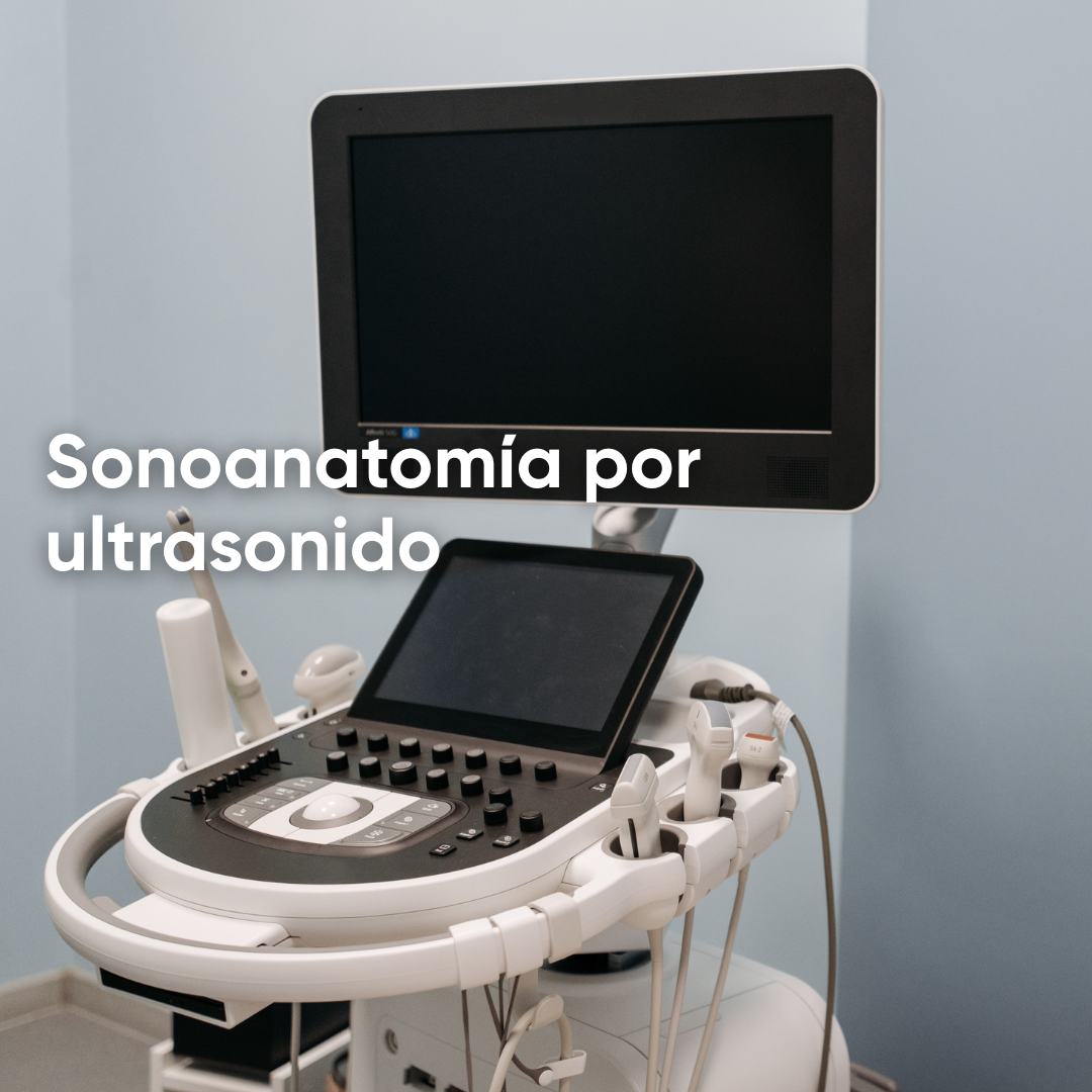 ¿Qué es la sonoanatomía y como se presenta en el ultrasonido