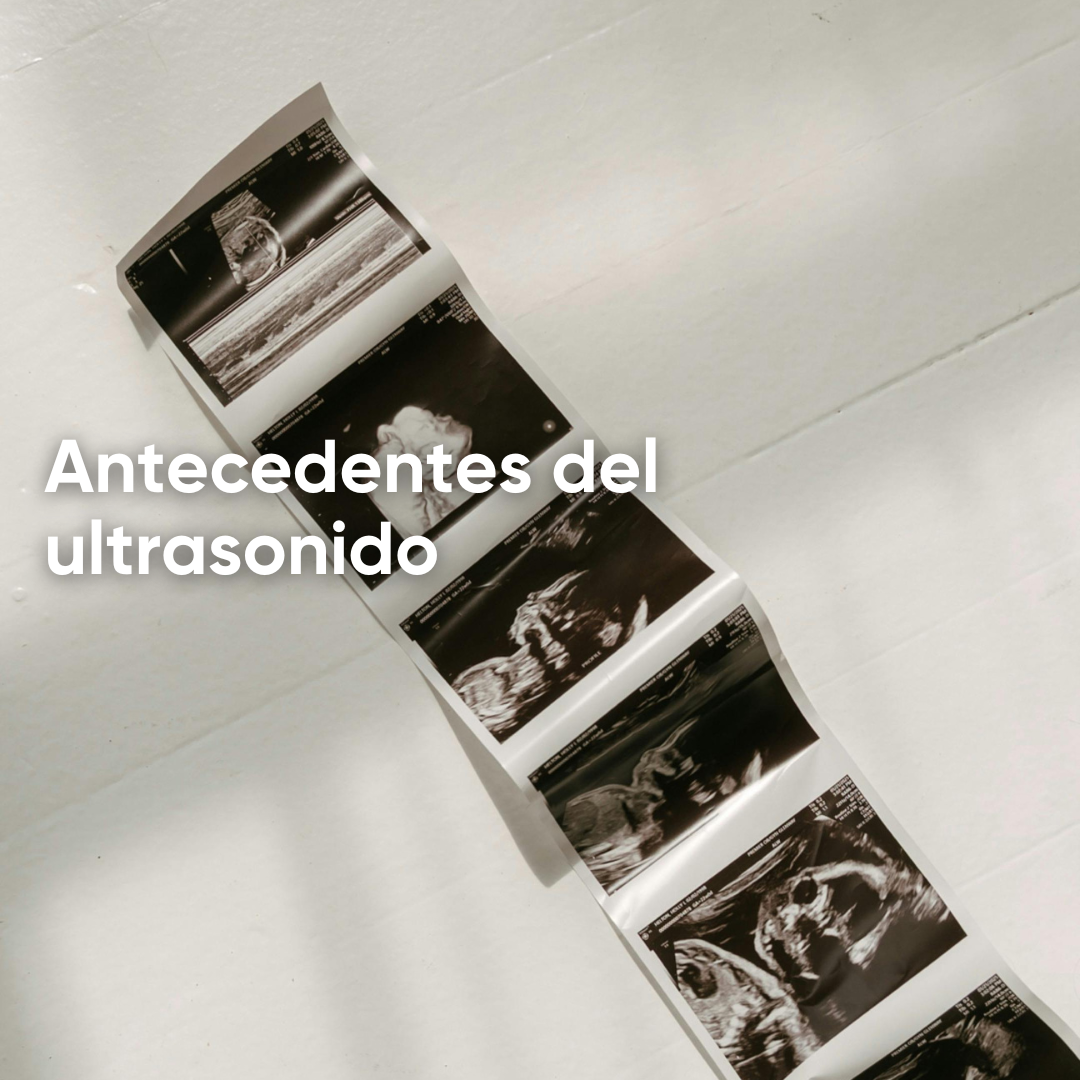 Antecedentes y usos del ultrasonido