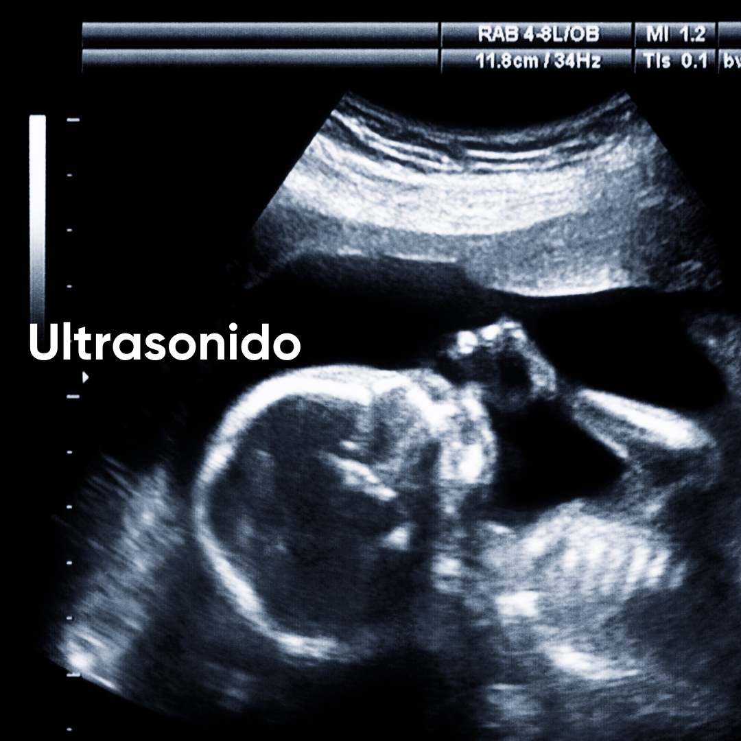 ¿Qué es el Ultrasonido?